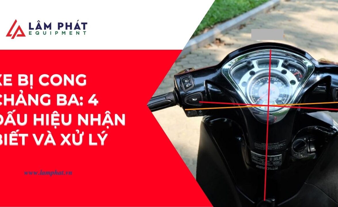 Có thể là chảng ba đã bị cong mà bạn không hề hay biết. Cùng khám phá cách nhận biết ngay!
